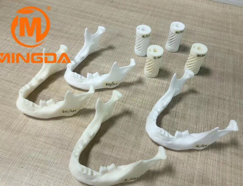工業(yè)級3D打印機在牙科行業(yè)的應用(圖1) 工業(yè)級3D打印機在牙科行業(yè)的應用(圖1)