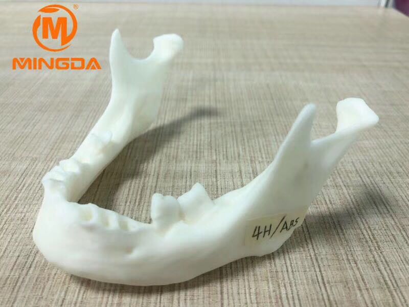 工業(yè)級3D打印機在牙科行業(yè)的應用(圖1) 工業(yè)級3D打印機在牙科行業(yè)的應用(圖1)