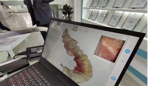  3D打印技術(shù)在牙科義齒領(lǐng)域中牙套制作的應用是怎樣的呢？(圖2)